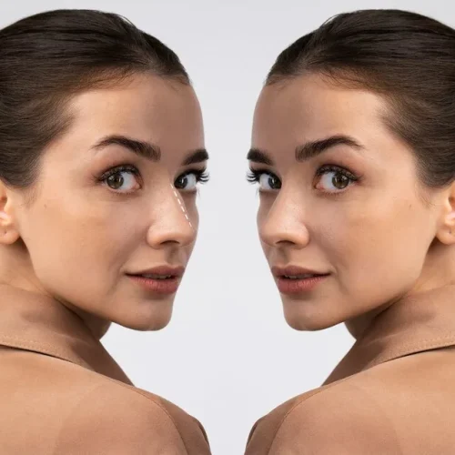 kris jenner face lift before and after